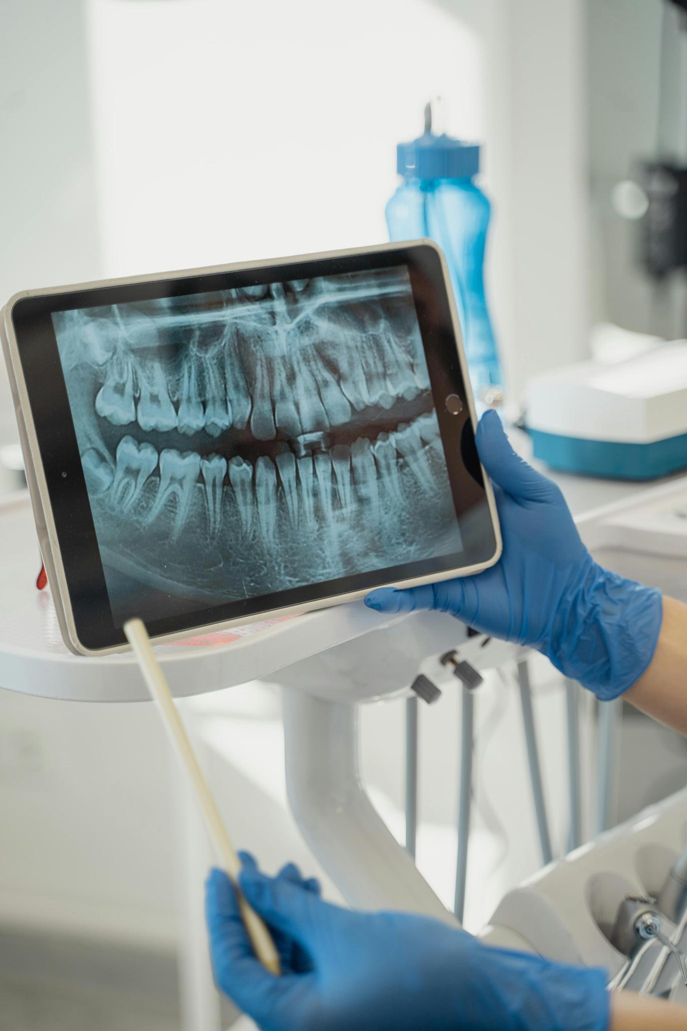 comment nettoyer un écran de tablette